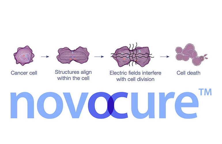 Novocure Touts Phase II Pancreatic Cancer Pilot Study - Drug Delivery ...