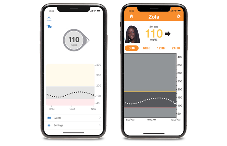 dexcom follow