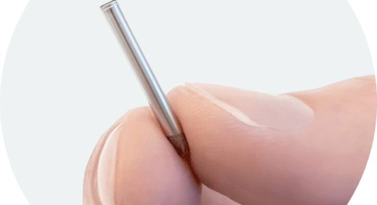 Vivani Medical initiates first-in-human GLP-1-eluting implant study