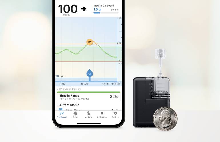FDA clears Tandem Mobi durable automated insulin pump