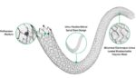 Medinol ChampioNIR drug-eluting stent